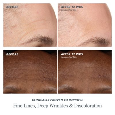 Milk RX Advanced Better Aging Wrinkle Serum
