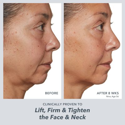+ Free Mini Milk RX Cream Milk RX Trio: 3-Step Better Aging Routine