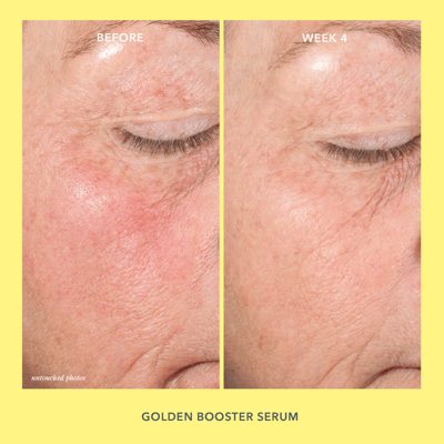 Brighter Days Routine Skincare Set